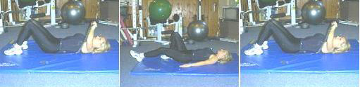 Tummy Tuck