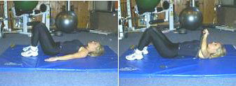 Tummy Tuck